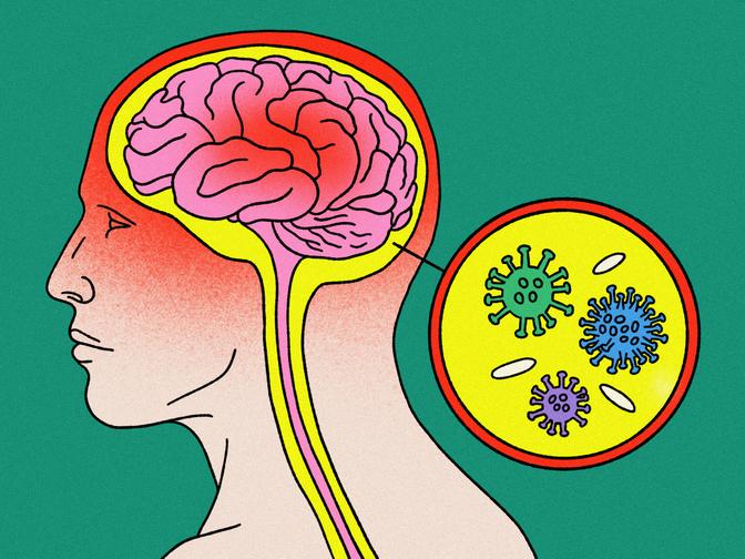 Darstellung eines menschlichen Kopfes im Profil, die das Gehirn mit einer Nahaufnahme von Bakterien zeigt, vor einem grünen Hintergrund.