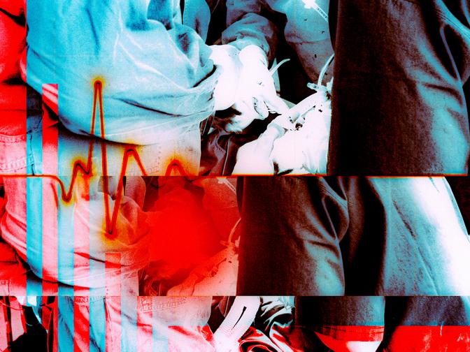 Chirurgen in blauen OP-Kitteln bei einer Operation, überlagert von roten Herzschlag- und Glitch-Effekten.
